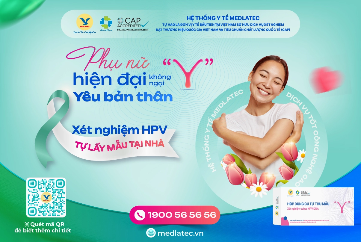 Ảnh tư liệu có mô tả Cây Me Rừng được giữ lại sau bước làm sạch dữ liệu