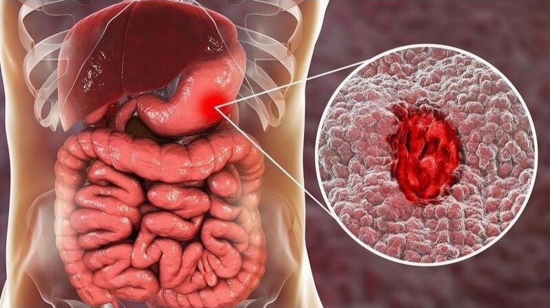 Cây Hoàng Kim Ngọc được minh họa cùng công dụng dân gian liên quan đến hỗ trợ cầm máu trong một số trường hợp tham khảo