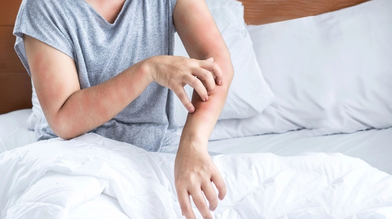 Hoa dành dành có thể gây dị ứng ở một số người tùy theo cơ địa