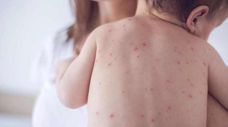 Lá Canh châu xanh được giới thiệu như giải pháp dân gian hỗ trợ chăm sóc khi thủy đậu